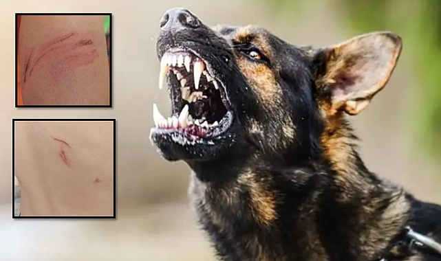 ŞANLIURFA HİLVAN\'DA KÖPEK DEHŞETİ! KÜÇÜK ÇOCUĞU ISIRDI